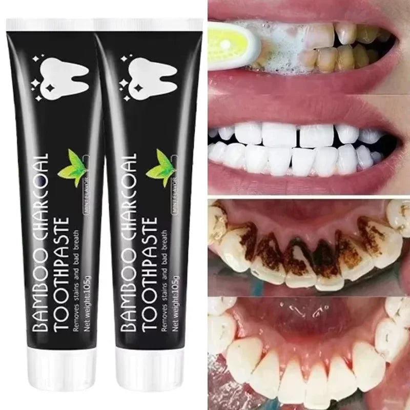 Creme dental clareador Creme dental de carvão de bambu adsorve o mau hálito remove dentes amarelos limpeza forte manchas nos dentes cuidados orais